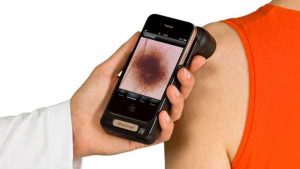 handyscope turns iPhone into Professional Dermatoscope